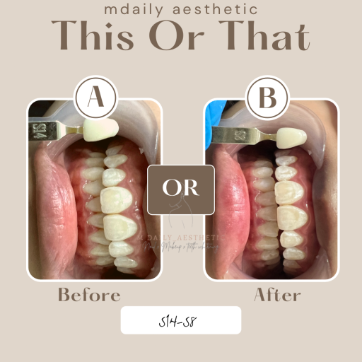 54126DBD-2720-43FE-94A6-590DEB362AC2